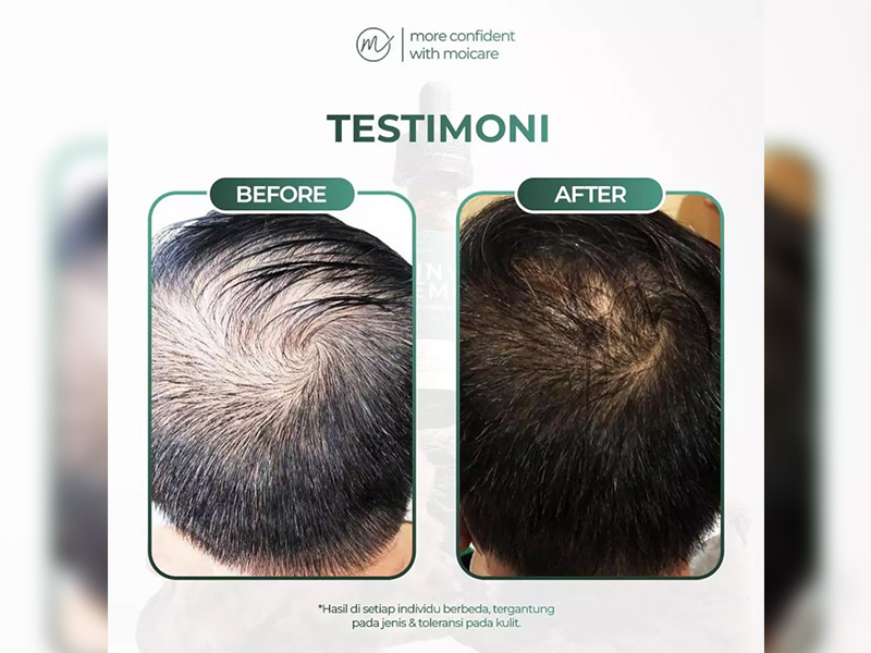 Moicare Minyak Kemiri Extract Ginseng 100%